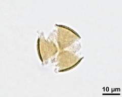 acetolyzed pollen,polar view,optical section