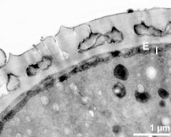 interapertural area of pollen wall, intine (I), endexine (E)