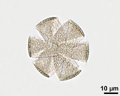 acetolyzed pollen, optical section