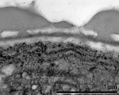 apertural area of pollen wall