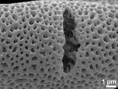 acetolyzed pollen,aperture