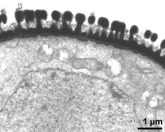 pollen wall, interapertural area