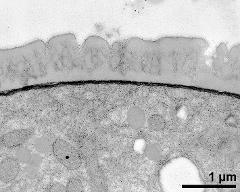 pollen wall, interapertural area