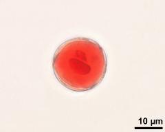 two-celled pollen grain