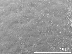 exine surface