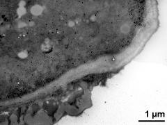 pollen wall, transition from aperture to interapertural area