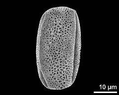 dry pollen grain in equatorial view