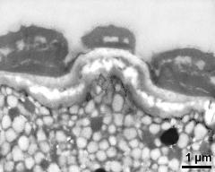 apertural area of pollen wall