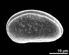 dry pollen grain in polar view (proximal)