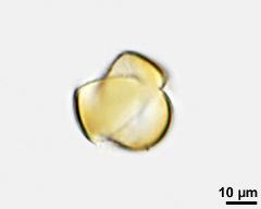 acetolyzed pollen, lower focus