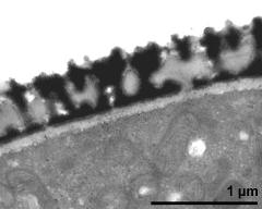 interapertural area of pollen wall