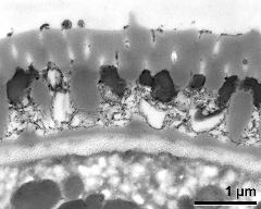 interapertural area of pollen wall