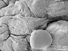 hydrated pollen,Ubisch bodies on locule wall