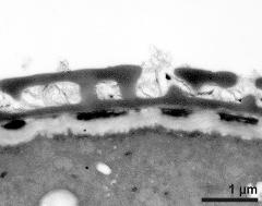 interapertural area of pollen wall