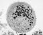 pollen grain in cross section