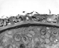 pollen wall; infratectum filled with pollenkitt (asterisks)