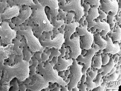exine surface