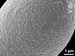 exine surface