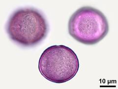 hydrated pollen,equatorial view