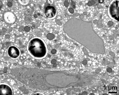 cytoplasm with vegetative nucleus, generative cell (below) and organells