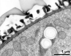 pollen wall, interapertural area, pollenkitt