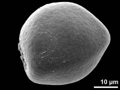 proximal polar view