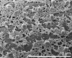 exine surface (irregurlarly ruptured)