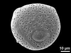 equatorial view (triporate grain)