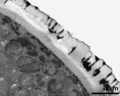 pollen wall, interapertural area