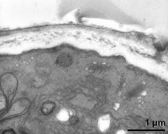 apertural area of pollen wall