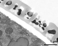 pollen wall; interapertural area