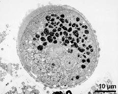 pollen grain in cross section