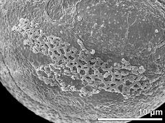 sulcus with operculum