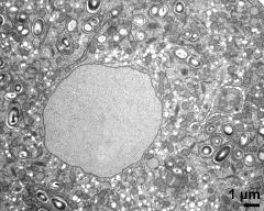 cytoplasm with vegetative nucleus, sperm cell and organells