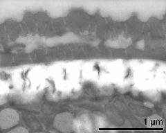 interapertural area of pollen wall