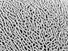 exine surface
