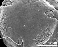 exine surface (polar area)