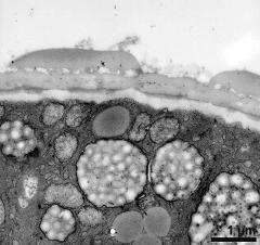 interapertural area of pollen wall