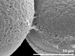 exine surface,connection between tetrads,bridge