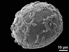 distal polar view