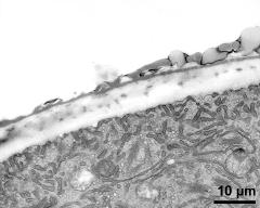 pollen wall at transition of aperture and interapertural area