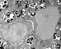 cytoplasm with vegetative nucleus and generative cell, lipids, mitochondria