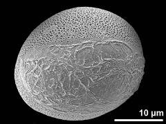 distal polar view