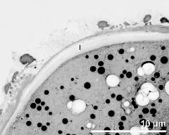 apertural area of pollen wall, intine (I)