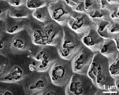 exine surface
