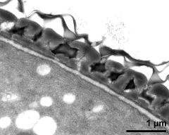 interapertural area of pollen wall