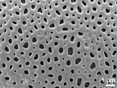 exine surface