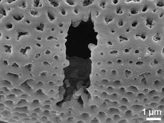 acetolyzed pollen,aperture