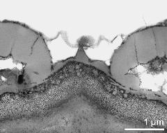 apertural area of pollen wall