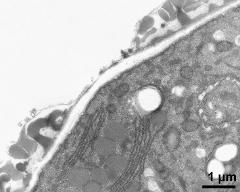 aperture area, note stacked endoplasmic reticulum